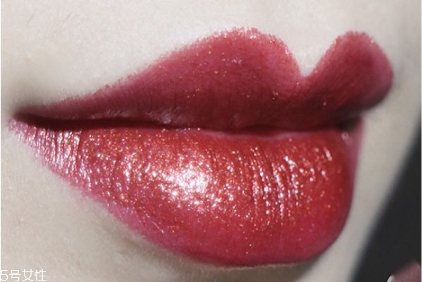 除皱针老年人打效果好吗(50岁打除皱针还好用吗)