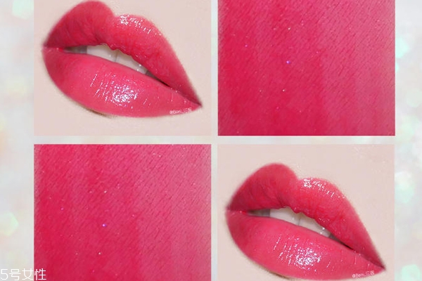 无痕去眼袋的缺点和优点(无痕去眼袋好吗?) 无痕去眼袋的缺点和优点(无痕去眼袋好吗?)