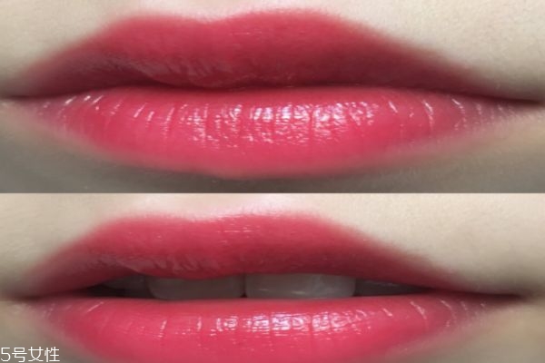 针灸丰胸是扎哪里(针灸丰胸是扎哪里)