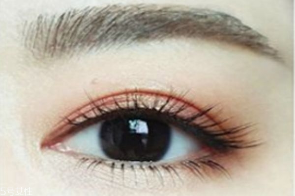 针灸减肥怎么避免反弹(针灸减肥反弹严重吗)