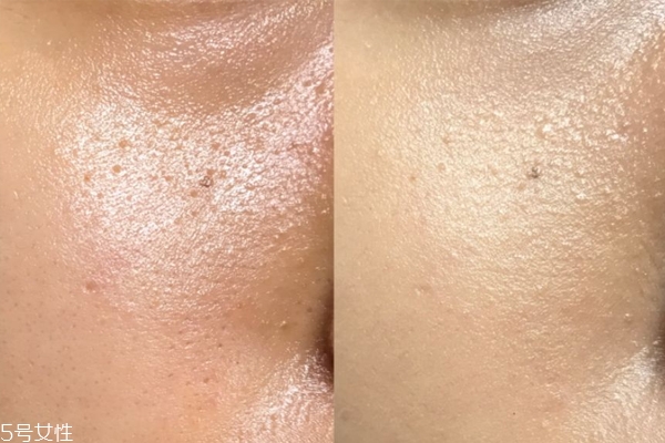 美人鱼肚脐贴介绍(美人鱼肚脐贴怎么用)