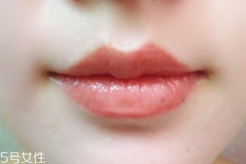 大象腿可以遗传吗(遗传大象腿还有救吗) 大象腿可以遗传吗(遗传大象腿还有救吗)