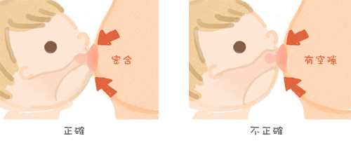 肥胖纹的预防和补救(肥胖纹怎么预防)