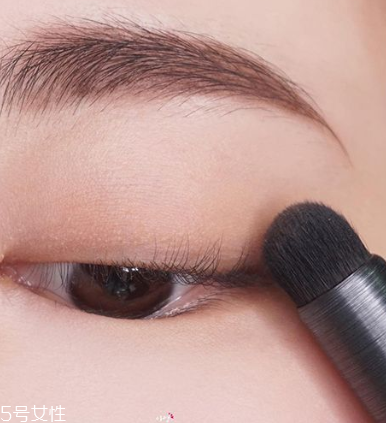 骨盆前倾怎么治疗(严重骨盆前倾怎么治疗)