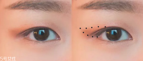 脱腋毛对身体排汗有害吗(脱腋毛影响排汗吗)