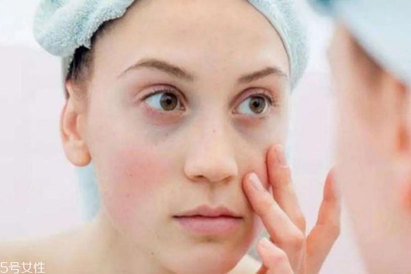 皮肤太薄怎么养厚,怎么让皮肤变厚