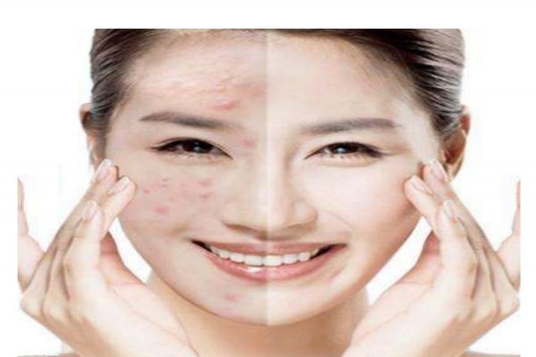 为什么脸上会长很硬的包,为什么脸上长硬硬的包