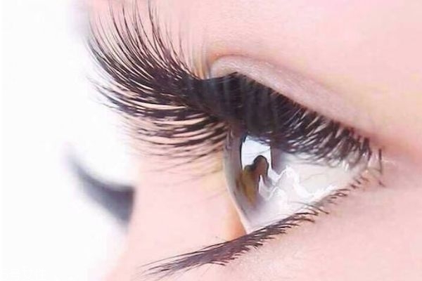 眼睫毛特别少怎么办,睫毛很少怎么办