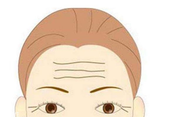 什么叫抬头纹,抬头纹是什么形状