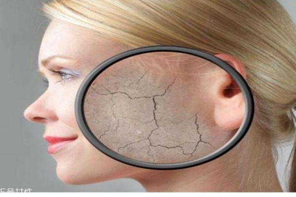 皮肤脱皮是什么原因,皮肤病脱皮啥原因