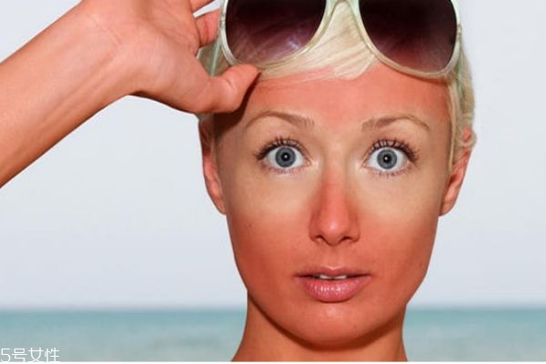 手机放在太阳下暴晒后怎么办,暴晒后怎么办