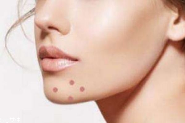 下巴两边为什么老长痘,脸的两侧和下巴长痘什么原因