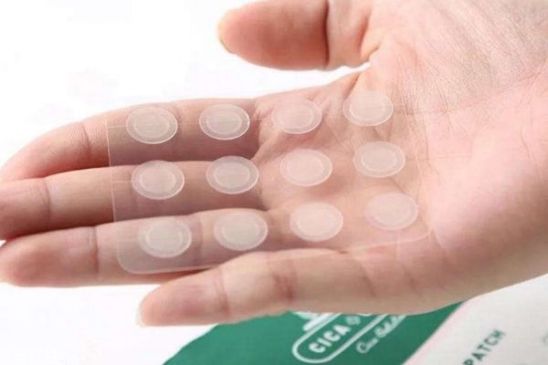 什么样的痘痘可以用痘痘贴,什么痘痘贴好用