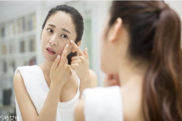 皮肤长痘的原因有哪些,痘痘形成的主要原因