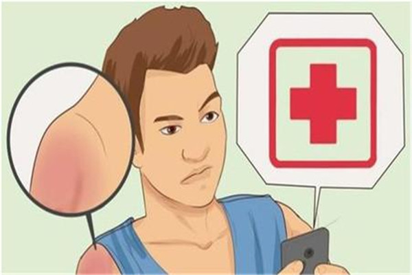 晒伤是什么症状,为什么会晒伤