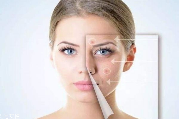 怎么才能让皮肤变好细腻白皙,怎么能让皮肤变白嫩,细腻