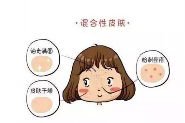 混合性皮肤如何护肤呢,混合皮肤怎么护肤