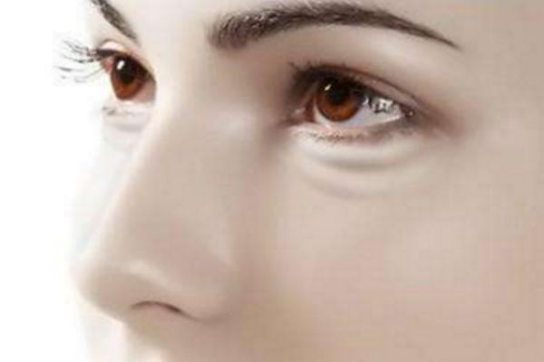 怎么祛除眼袋和黑眼圈,如何有效去除眼袋和黑眼圈