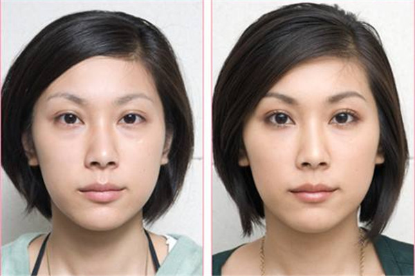 眼袋发黑怎么解决,眼袋黑色怎么消除简单方法 眼袋发黑怎么解决,眼袋黑色怎么消除简单方法