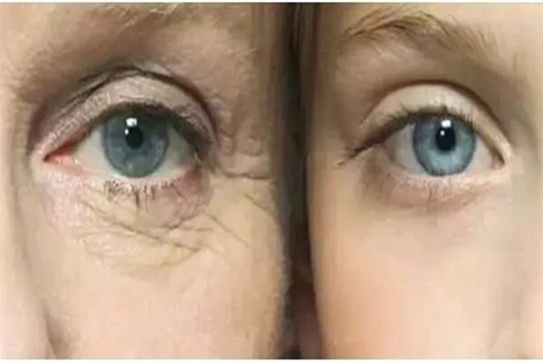 二十几岁用什么眼霜比较好,二十多岁适合用什么眼霜