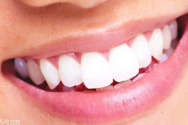 牙贴会损伤牙齿吗,牙贴会损坏牙齿吗 牙贴会损伤牙齿吗,牙贴会损坏牙齿吗