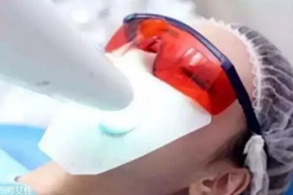 美牙仪伤牙齿吗,美牙仪对牙齿伤害大吗 美牙仪伤牙齿吗,美牙仪对牙齿伤害大吗