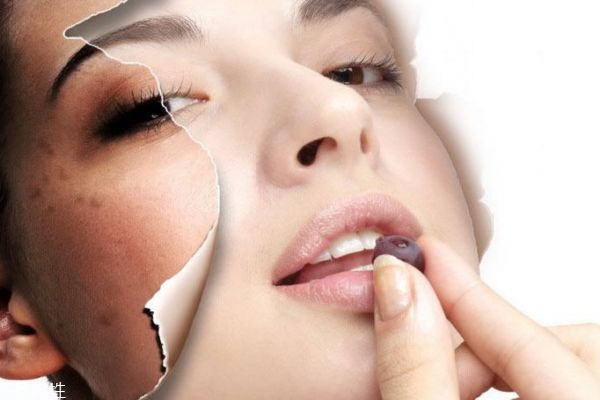 脸上拔罐可以祛斑吗,面部拔罐祛斑效果如何