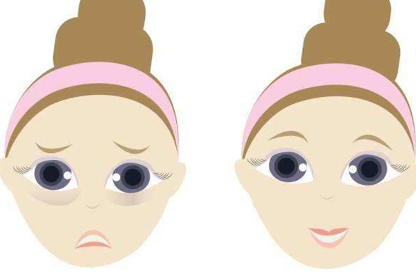 经常揉眼袋可以消除吗,眼袋按摩可以消除吗