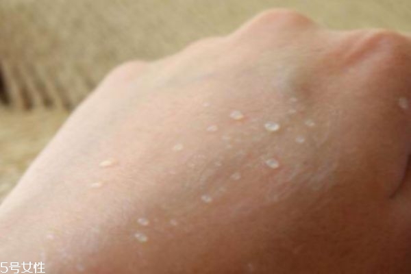 什么叫爆水霜,爆水霜是干嘛的 什么叫爆水霜,爆水霜是干嘛的