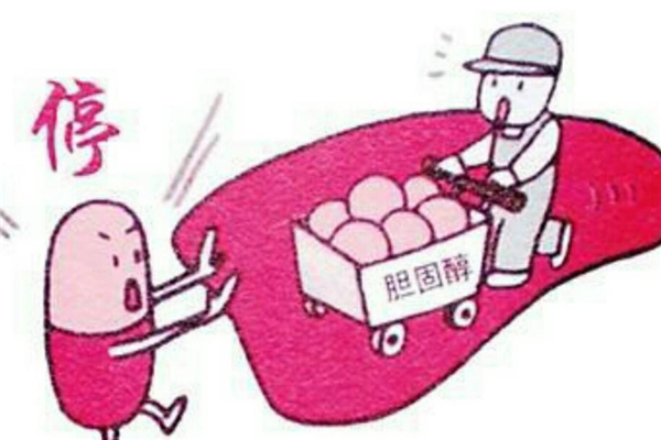 胆固醇高需要吃药吗?吃什么药,胆固醇高需要吃药吗?