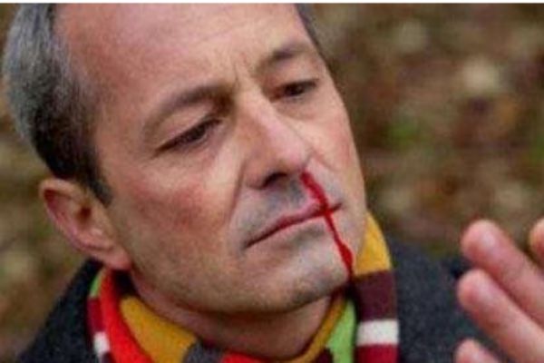 美白精华是什么,什么美白精华效果好点的?