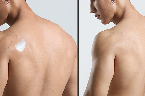 pmpm玫瑰水乳适合什么肤质,馥蕾诗玫瑰水适合什么肤质