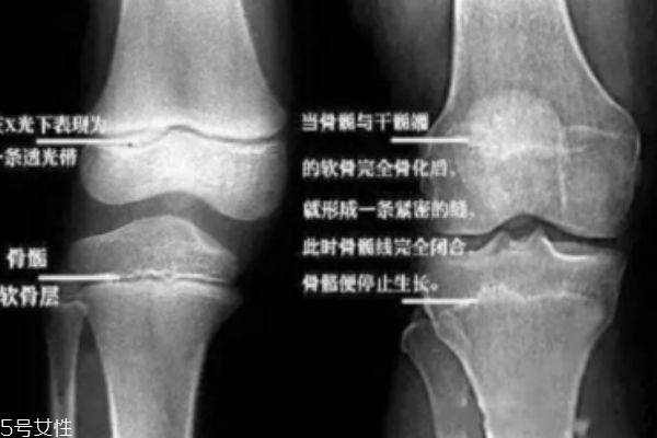 长高和什么有关系,长高和什么有关系图片