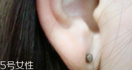 打耳洞有几种方式,打耳洞是用什么打的 打耳洞有几种方式,打耳洞是用什么打的