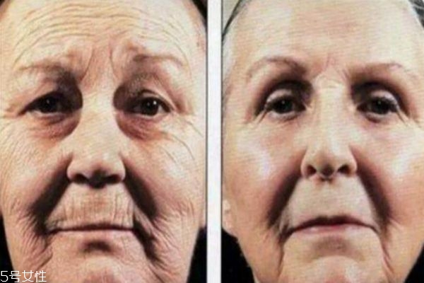 每天坚持涂防晒霜的变化,每天坚持涂防晒