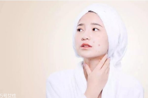 敏感肌肤会自己修复吗,敏感肌会自己恢复吗