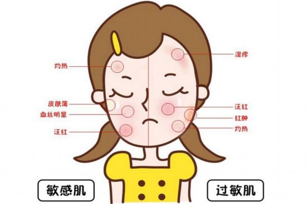 敏感肌肤如何修复小妙招,过敏皮肤怎么修复