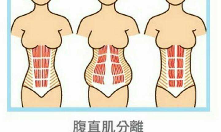 锻炼腹直肌的方法,锻炼腹直肌的方法有哪些