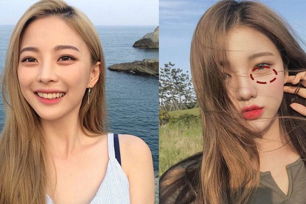 怎样区分卧蚕和眼袋,如何区分眼袋和卧蚕眼