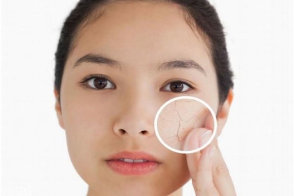 如何给皮肤补水 小妙招,给皮肤补水应该怎么做?