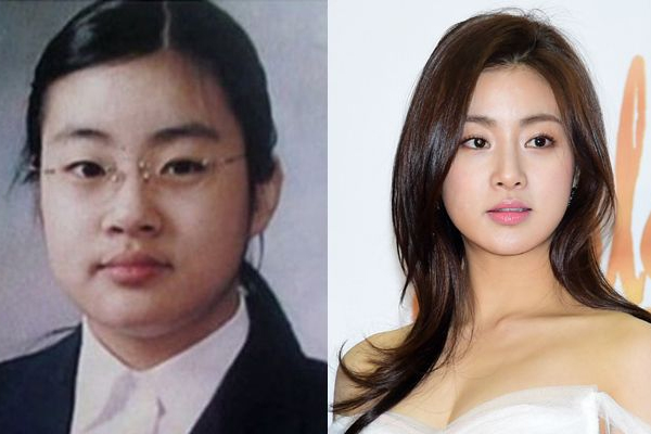 吃什么可以消脸水肿,脸上水肿怎么消除最快方法