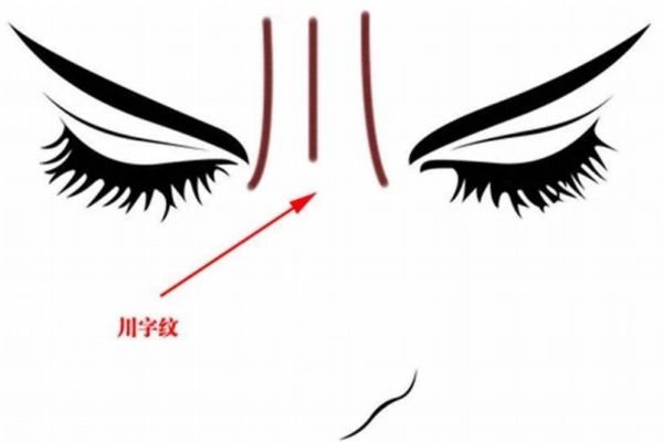 川字纹怎么形成的原因,川字纹是怎么形成的