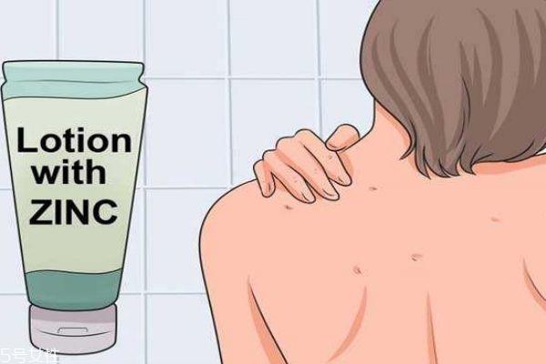 为什么背上会长很多痘痘怎么办,为什么满背都是痘痘