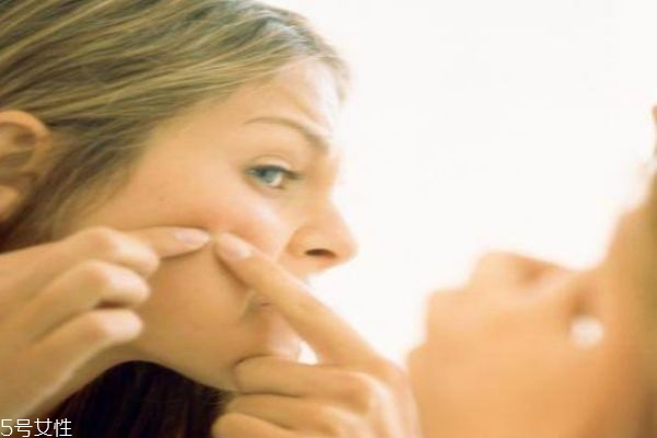 激素脸的症状表现有哪些,激素脸是怎么造成的