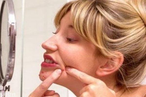 下巴的粉刺可以挤吗,为什么下巴的粉刺越挤越多