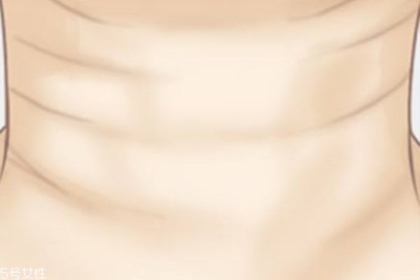 颈纹是不是根本消不掉,颈纹有办法消除吗