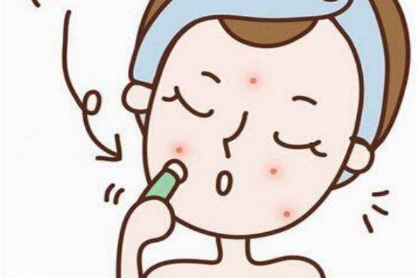 脸上的白头粉刺怎么去除,脸上老是长白头粉刺怎么办