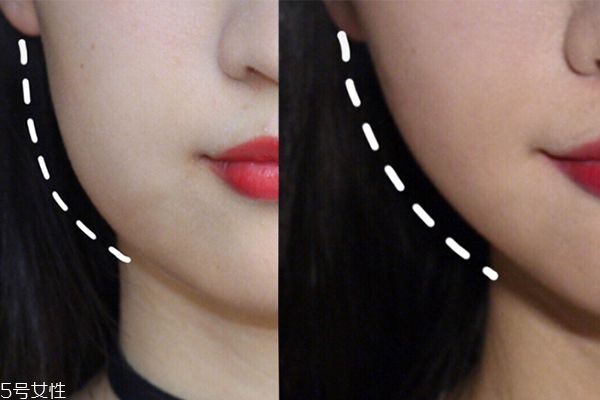 如何消除早上脸部水肿,早上起床脸水肿怎么消除