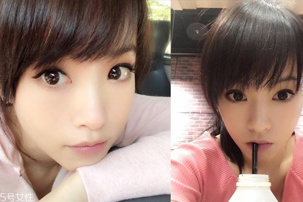 油痘肌怎么改善,油痘肌怎么护肤