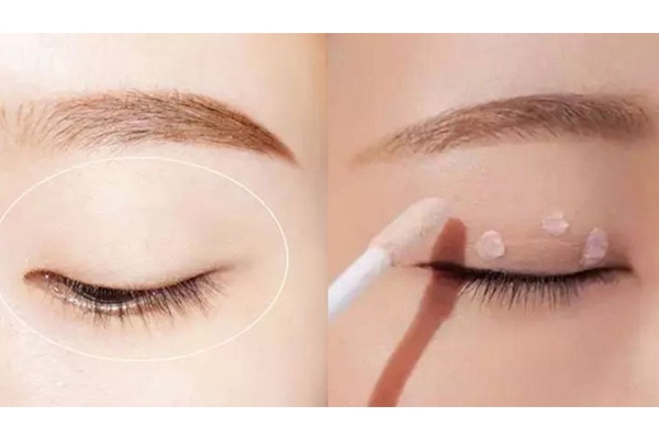 内双肿眼泡怎么画眼妆,内双肿泡眼怎么变成双眼皮 内双肿眼泡怎么画眼妆,内双肿泡眼怎么变成双眼皮